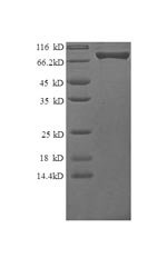 Human Granulocyte colony-stimulating factor receptor (CSF3R), partial Recombinant Protein, N-GST, Homo sapiens (Human), E.coli, N-terminal GST-tagged, 93.5 kDa, purity >≥ 90% as determined by SDS-PAGE.