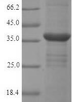 Rat Monoglyceride lipase (Mgll) Recombinant Protein - BioCrest Sci