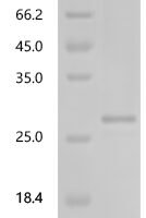 Human Erythroferrone(ERFE),partial Recombinant Protein - BioCrest Sci