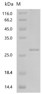 Human Erythroferrone(ERFE),partial Recombinant Protein, Homo sapiens (Human), E.coli, N-terminal 6xHis-tagged, 24.4 kDa, purity >≥ 85% as determined by SDS-PAGE.