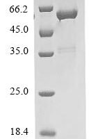 Mouse Guanine nucleotide-binding protein G (i) subunit alpha-2 (Gnai2) Recombinant Protein, N-His - BioCrest Sci