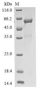 Mouse Guanine nucleotide-binding protein G (i) subunit alpha-2 (Gnai2) Recombinant Protein, N-His, Mus musculus (Mouse), E.coli, N-terminal 6xHis-tagged, 44.4 kDa, purity >≥ 90% as determined by SDS-PAGE.