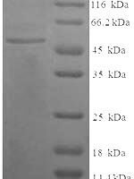 Human Complement C4-B (C4B), partial Recombinant Protein, N-His-SUMO - BioCrest Sci