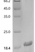 Human Epithelial membrane protein 2 (EMP2), partial Recombinant Protein - BioCrest Sci