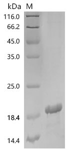 Human Epithelial membrane protein 2 (EMP2), partial Recombinant Protein, Homo sapiens (Human), E.coli, N-terminal 6xHis-KSI-tagged, 18.6 kDa, purity >≥ 85% as determined by SDS-PAGE.