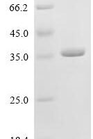 Human Deleted in azoospermia-like (DAZL), partial Recombinant Protein, N-His-SUMO - BioCrest Sci