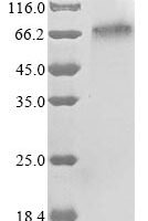 Human Integrin beta-like protein 1 (ITGBL1) Recombinant Protein - BioCrest Sci