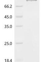 Mouse Heat shock protein HSP 90-beta (Hsp90ab1) Recombinant Protein, C-10His - BioCrest Sci