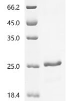 Drosophila simulans SAGA-associated factor 11 homolog (Sgf11) Recombinant Protein - BioCrest Sci