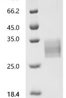 Mouse Interleukin-6 (Il6) Recombinant Protein, N-10His - BioCrest Sci