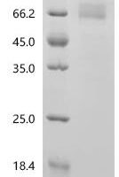 Human Interleukin-32 (IL32) Recombinant Protein, N-hFc1/C-10His - BioCrest Sci