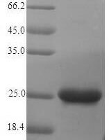 Vibrio vulnificus Fe/S biogenesis protein NfuA (nfuA) Recombinant Protein, N-His, aa 1–194, strain CMCP6 - BioCrest Sci