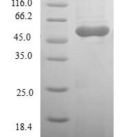 Human Ras association domain-containing protein 5 (RASSF5) Recombinant Protein - BioCrest Sci