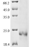 Bovine Interleukin-7 (IL7) Recombinant Protein - BioCrest Sci