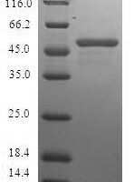 Human Charged multivesicular body protein 2b (CHMP2B) Recombinant Protein - BioCrest Sci