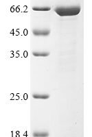 Mouse Liver carboxylesterase 1 (Ces1) Recombinant Protein - BioCrest Sci