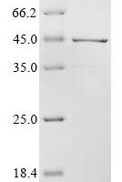Rat Apolipoprotein E (Apoe) Recombinant Protein - BioCrest Sci