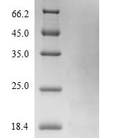Hypocrea jecorina Hydrophobin-2 (hfb2) Recombinant Protein, N-10His-B2M-JD - BioCrest Sci