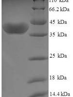 Human Uridine-cytidine kinase 1 (UCK1) Recombinant Protein - BioCrest Sci