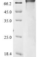 Human Choline O-acetyltransferase (CHAT),Partial Recombinant Protein, N-10His/C-Myc - BioCrest Sci