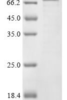Bifidobacterium bifidum NCIMB 41171 Beta-galactosidase (bbgII) Recombinant Protein - BioCrest Sci