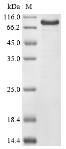 Bifidobacterium bifidum NCIMB 41171 Beta-galactosidase (bbgII) Recombinant Protein, Bifidobacterium bifidum NCIMB 41171, E.coli, N-terminal 10xHis-tagged and C-terminal Myc-tagged, 84.7 kDa, purity >≥ 85% as determined by SDS-PAGE.