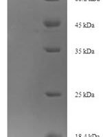 Mouse Oxysterol-binding protein-related protein 11 (Osbpl11) Recombinant Protein - BioCrest Sci