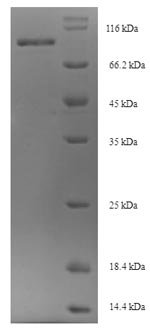 Mouse Oxysterol-binding protein-related protein 11 (Osbpl11) Recombinant Protein, Mus musculus (Mouse), E.coli, N-terminal 6xHis-SUMO-tagged, 99.6 kDa, purity >≥ 90% as determined by SDS-PAGE.