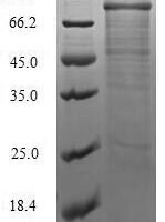 Vaccinia virus Protein OPG068 (OPG068) Recombinant Protein - BioCrest Sci