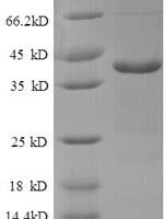Human V-type proton ATPase subunit F (ATP6V1F) Recombinant Protein - BioCrest Sci