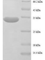Escherichia coli 50S ribosomal protein L32 (rpmF) Recombinant Protein - BioCrest Sci
