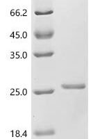 Pseudomonas phage phi6 Major outer capsid protein (P8) Recombinant Protein - BioCrest Sci