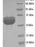 Saccharomyces cerevisiae TATA-box-binding protein (SPT15) Recombinant Protein, N-His, aa 2–240, Yeast - BioCrest Sci