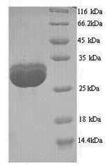 Saccharomyces cerevisiae TATA-box-binding protein (SPT15) Recombinant Protein, N-His, aa 2–240, Yeast, Saccharomyces cerevisiae (strain ATCC 204508 / S288c) (Baker's yeast), Yeast, N-terminal 6xHis-tagged, 28.9 kDa, purity >≥ 90% as determined by SDS-PAGE.