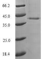 Aequorea victoria Green fluorescent protein (GFP) Recombinant Protein, N-His-SUMO - BioCrest Sci
