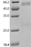 Human Galectin-9 (LGALS9)(W309A) Recombinant Protein, C-10His - BioCrest Sci
