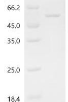 Human Actin-related protein 3 (ACTR3) Recombinant Protein, C-His - BioCrest Sci