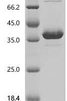 Mouse Resistin (Retn) Recombinant Protein, N-hFc1 - BioCrest Sci