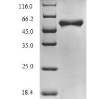 Halalkalibacterium halodurans Putative adenine deaminase BH0637 (BH0637), partial Recombinant Protein - BioCrest Sci