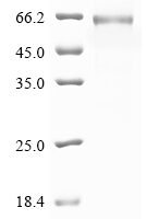 Dog Angiopoietin-1 (ANGPT1) Recombinant Protein, C-His, aa 20–497, Baculovirus - BioCrest Sci