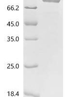 avian paramyxovirus 4 Nucleocapsid (NP) Recombinant Protein, C-hFc1 - BioCrest Sci