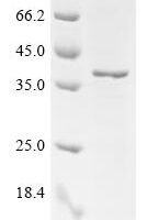 Mouse IgG receptor FcRn large subunit p51 (Fcgrt), partial Recombinant Protein - BioCrest Sci