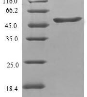 Human Tubulin polymerization-promoting protein (TPPP) Recombinant Protein - BioCrest Sci