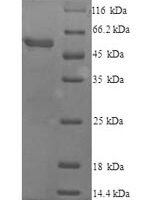 Mouse Cytochrome P450 2E1 (Cyp2e1), partial Recombinant Protein, N-His, aa 2–493, Yeast - BioCrest Sci