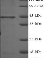 Human 17-beta-hydroxysteroid dehydrogenase 14 (HSD17B14) Recombinant Protein - BioCrest Sci