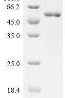 Mouse Fibroblast growth factor 9 (Fgf9) Recombinant Protein, N-hFc1 - BioCrest Sci