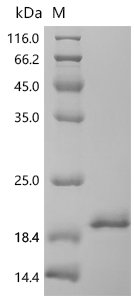 Macaca fascicularis Interleukin-1 beta (IL1B) Recombinant Protein, N-His, aa 117–268, Yeast, Macaca fascicularis (Crab-eating macaque), Yeast, N-terminal 6xHis-tagged, 19.2 kDa, purity >Greater than 95% as determined by SDS-PAGE.