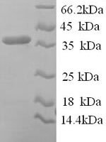 Human Reticulocalbin-1 (RCN1), partial Recombinant Protein - BioCrest Sci