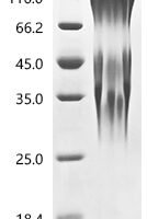 Mouse Ly6/PLAUR domain-containing protein 3 (Lypd3) Recombinant Protein, C-10His - BioCrest Sci