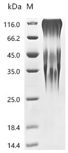 Mouse Ly6/PLAUR domain-containing protein 3 (Lypd3) Recombinant Protein, C-10His, Mus musculus (Mouse), Yeast, C-terminal 10xHis-tagged, 33.5 kDa, purity >≥ 95% as determined by SDS-PAGE.